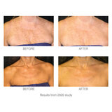 Image showing the results of the Rio Deco Lite Beauty Treatment